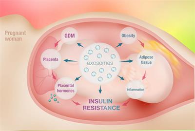 Retained placental fragments pathophysiology of diabetes 1 no risk matched betting review